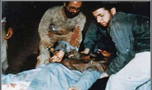 Ayatollah Khamenei, Current supreme leader of Iran, a few minutes after an attempted assassination on July 1981.